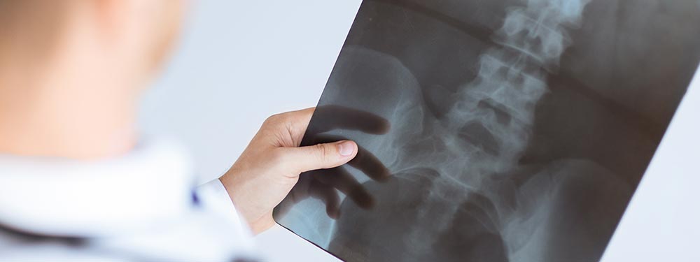 services banner osteoporosis